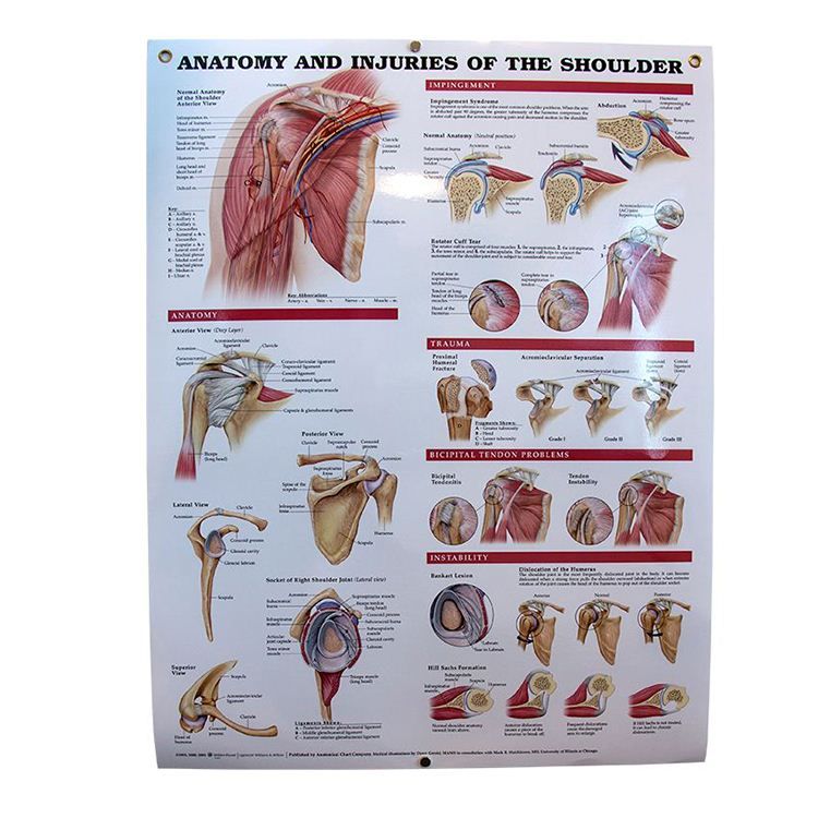 Anatomia E Lesioni Della Spalla – Poster Anatomico 50x66 Cm, Carta Pesante, Illustrazioni Dettagliate, Made In USA