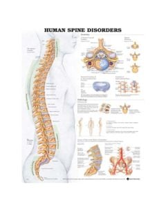 Human Spine Disorders