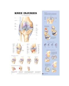 Knee Injuries