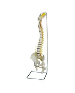Flexible Spine w/Herniated Disc Model