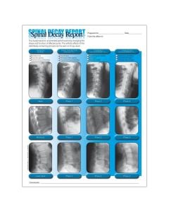 Right Spinal Decay Insert