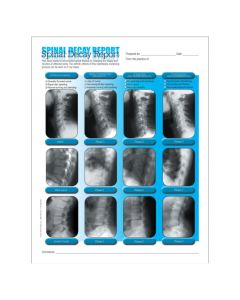 Left Spinal Decay Insert