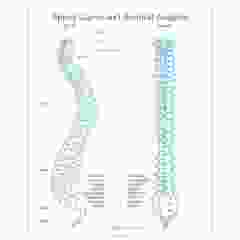 Left Postural Analysis