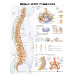 Human Spine Disorders