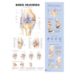 Knee Injuries