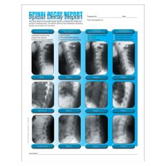 Left Spinal Decay Insert