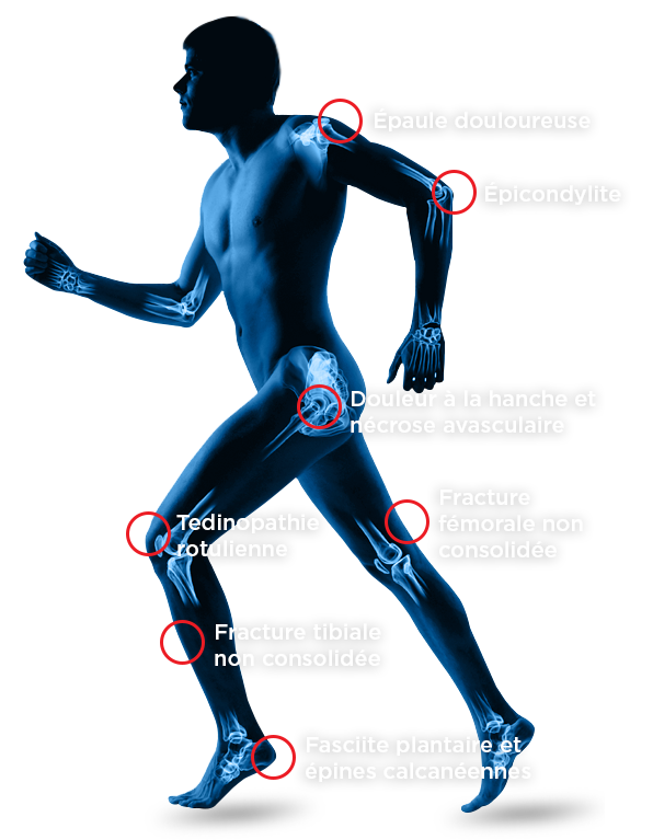 BTLFocus_Videos_fr_1