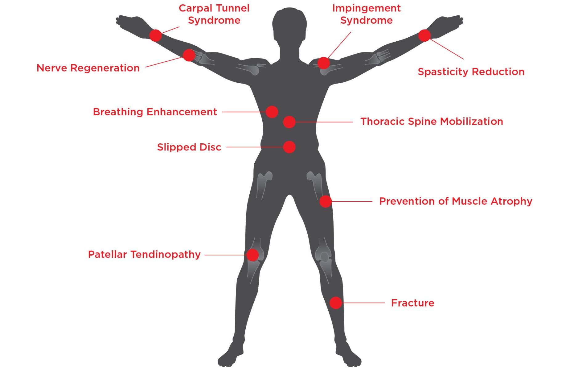 BTL-SIS-Features-2-with-Type-EN