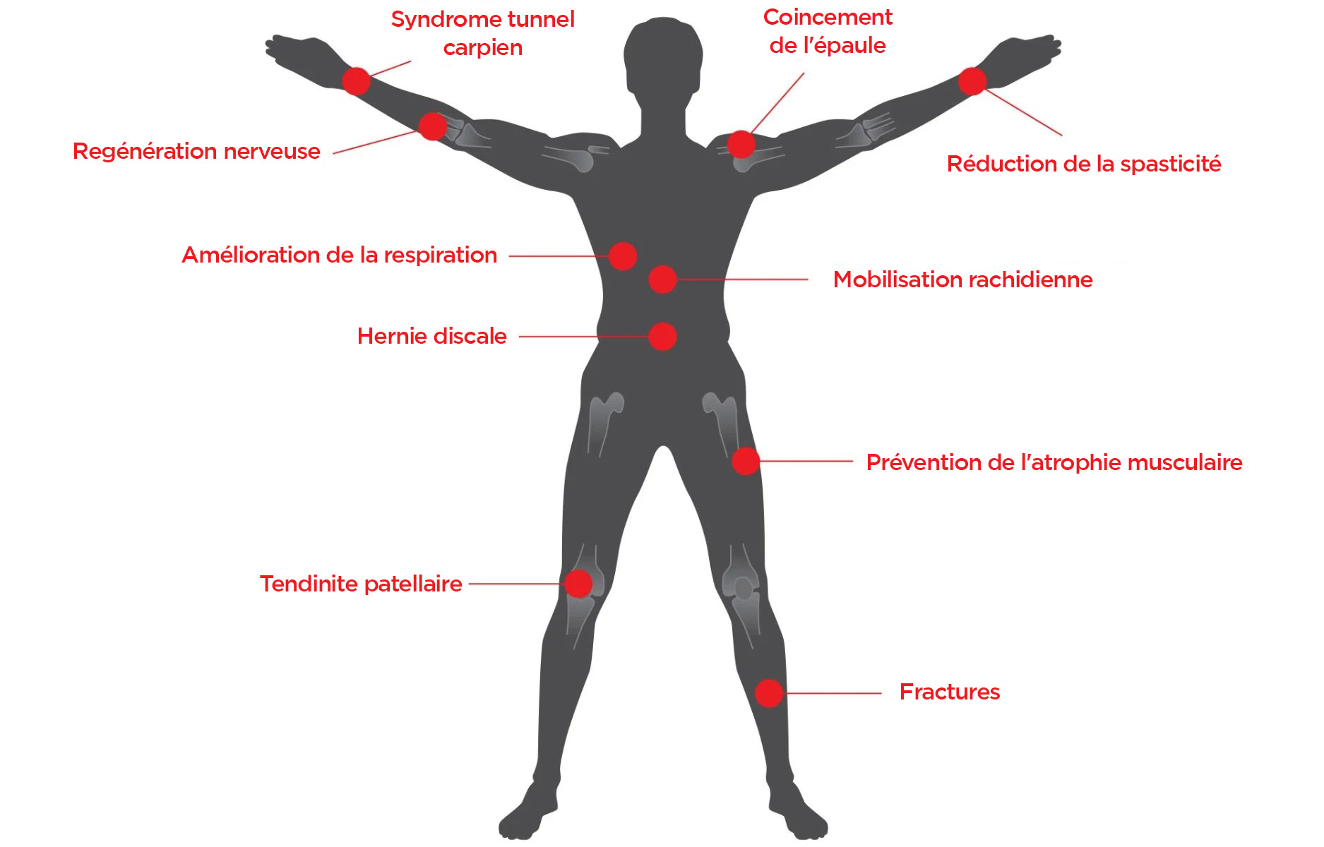 BTL-SIS-Features-2-with-Type-FR